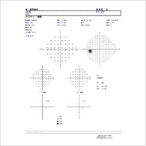 視野検査（HFA）