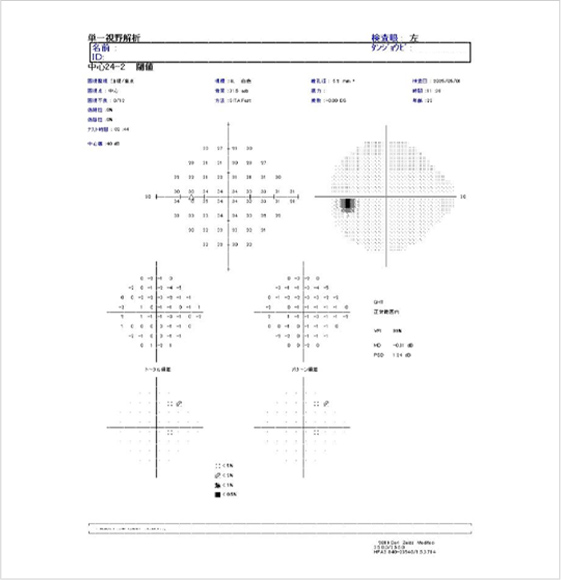 視野検査（HFA）