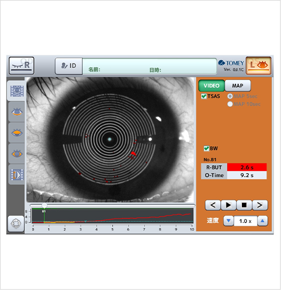 涙液層破壊時間（BUT）