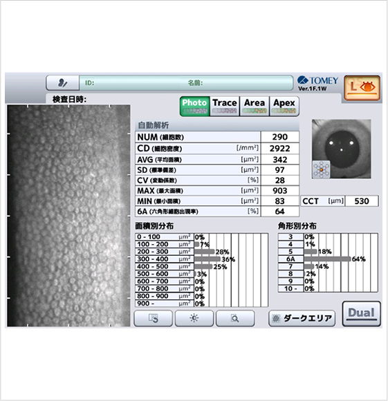 角膜内皮細胞検査