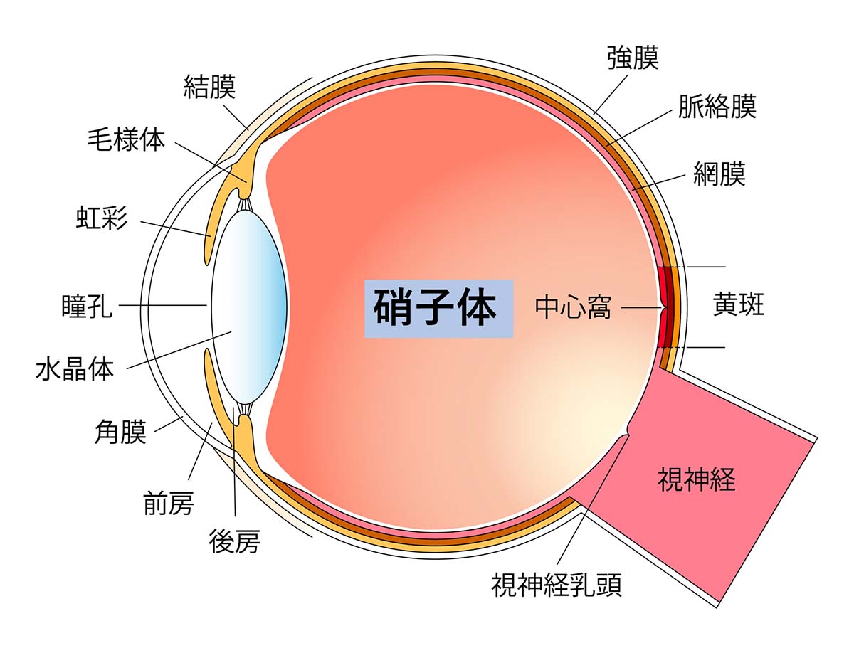 硝子体手術