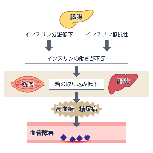糖尿病とは
