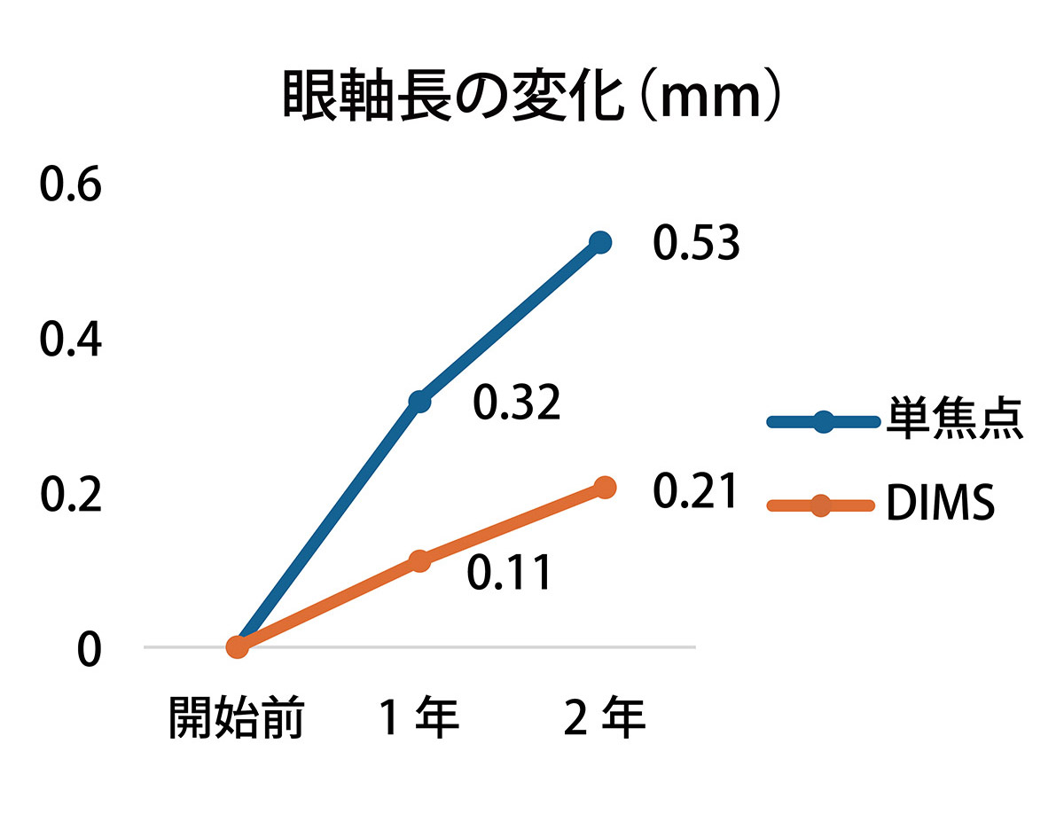 眼軸長の変化(mm)